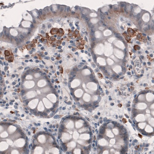 FCRN/FCGRT Antibody (CL3640) - BSA Free Immunohistochemistry-Paraffin: FCRN/FCGRT Antibody (CL3640) [NBP2-61627]
