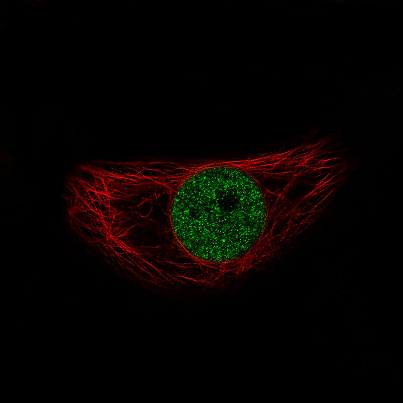 Snail Antibody (CL3700) - BSA Free Immunocytochemistry/ Immunofluorescence: Snail Antibody (CL3700) [NBP3-52471]