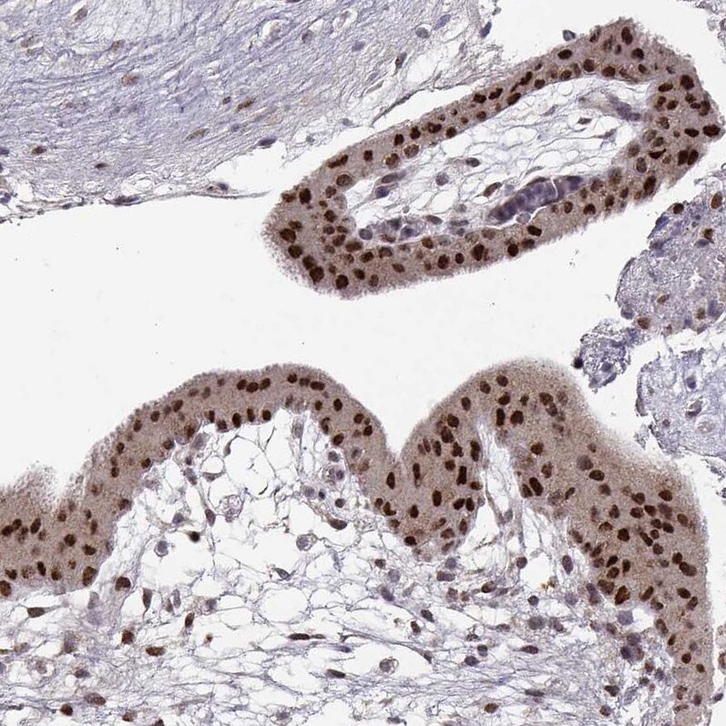 Snail Antibody (CL3700) - BSA Free Immunohistochemistry: Snail Antibody (CL3700) [NBP3-52471]
