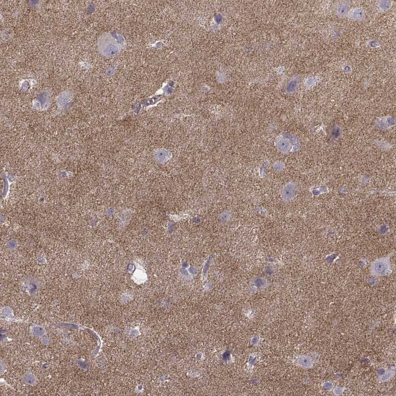 N-Cadherin Antibody (CL3716) - BSA Free Immunohistochemistry-Paraffin: N-Cadherin Antibody (CL3716) [NBP2-61632]