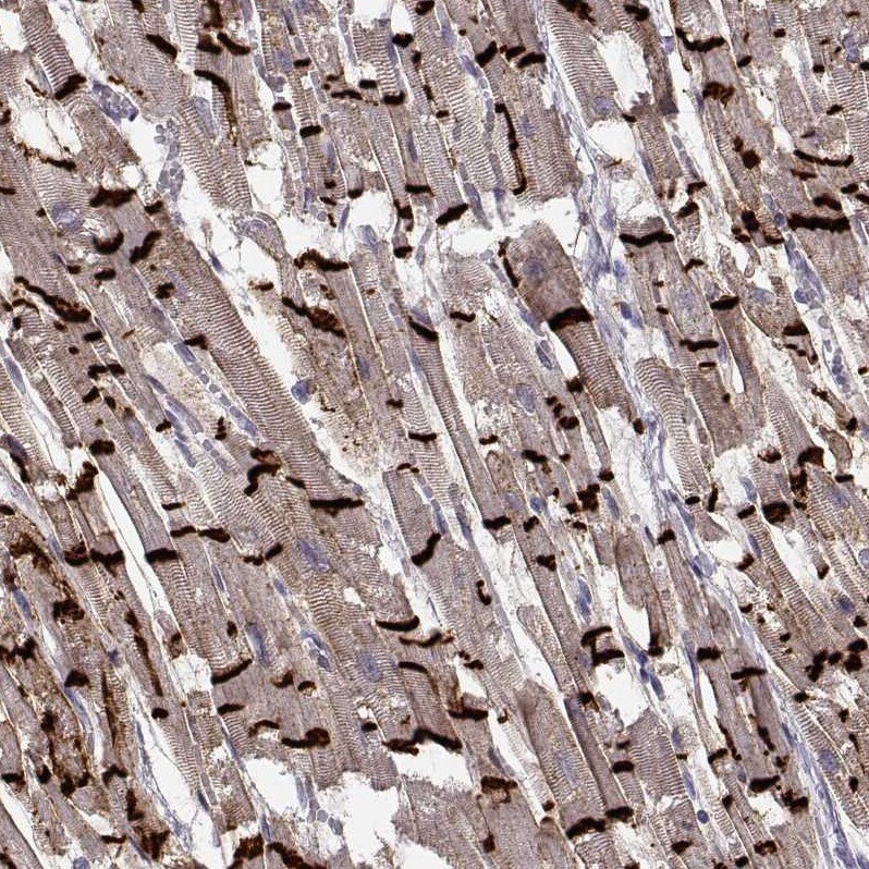 N-Cadherin Antibody (CL3716) - BSA Free Immunohistochemistry-Paraffin: N-Cadherin Antibody (CL3716) [NBP2-61632]