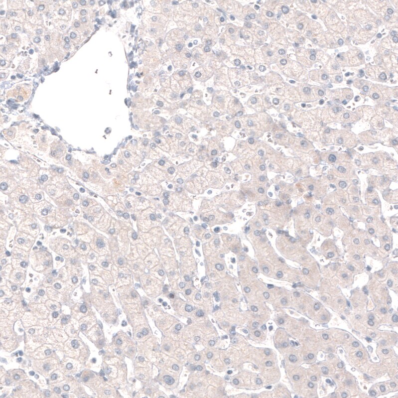 GRHL2 Antibody (CL3760) - BSA Free Immunohistochemistry-Paraffin: GRHL2 Antibody (CL3760) [NBP2-61634]