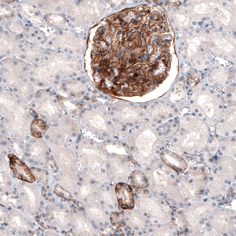 THSD7A Antibody (CL3778) - BSA Free Immunohistochemistry: THSD7A Antibody (CL3778) [NBP3-52472]