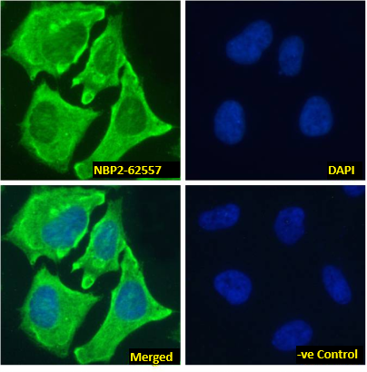 Notch-1 Antibody (E6) - Chimeric - Azide and BSA Free