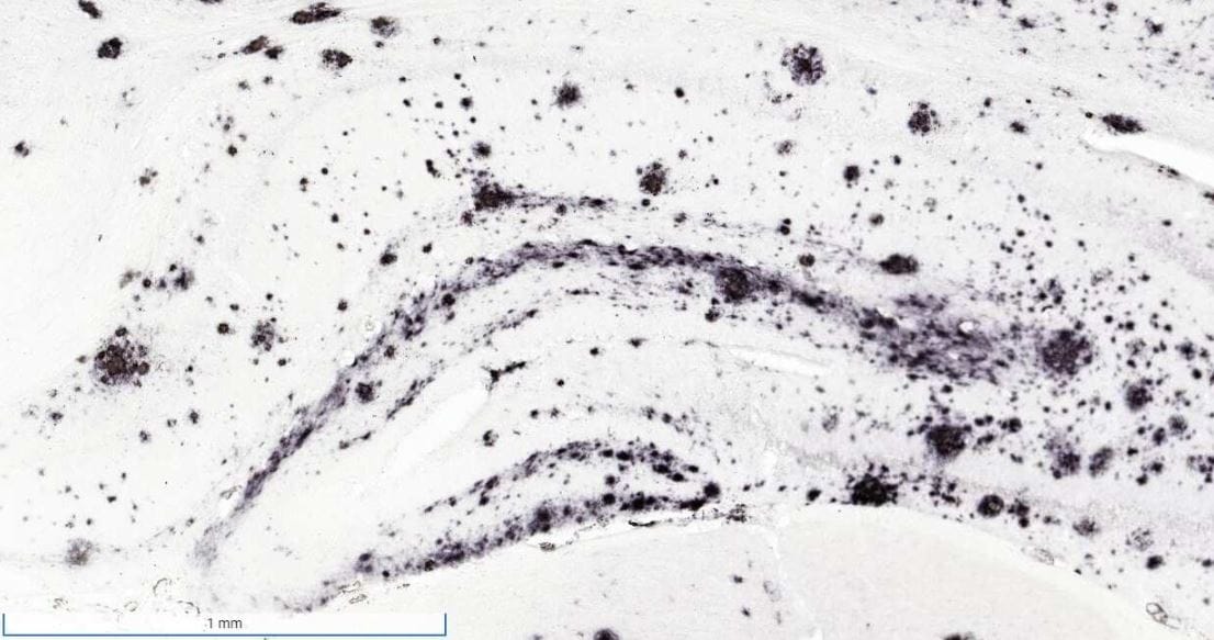APP Antibody (6E10) - Chimeric - Azide and BSA Free
