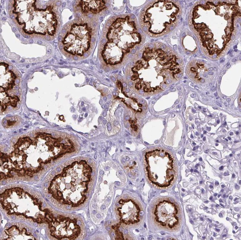 Cubilin Antibody - BSA Free Immunohistochemistry-Paraffin: Cubilin Antibody [NBP2-62596]