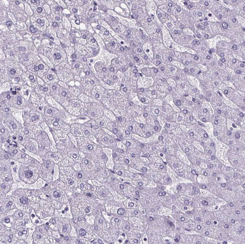 Cubilin Antibody - BSA Free Immunohistochemistry-Paraffin: Cubilin Antibody [NBP2-62596]