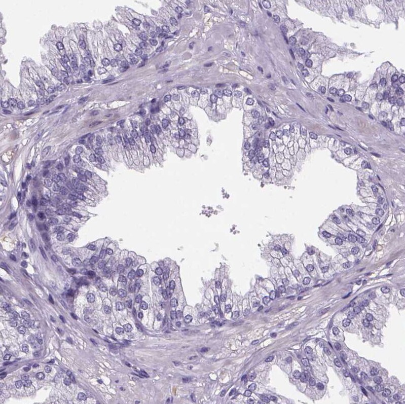 Cubilin Antibody - BSA Free Immunohistochemistry-Paraffin: Cubilin Antibody [NBP2-62596]
