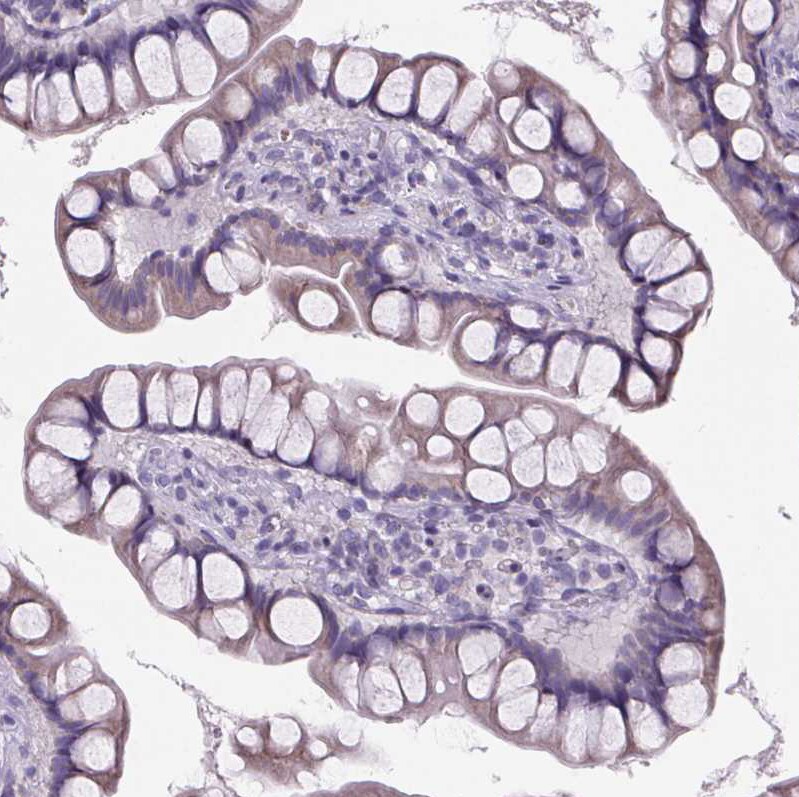 Cubilin Antibody - BSA Free Immunohistochemistry-Paraffin: Cubilin Antibody [NBP2-62596]