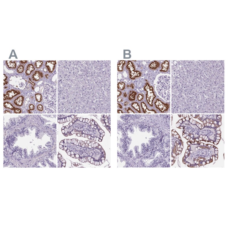 Cubilin Antibody - BSA Free Immunohistochemistry-Paraffin: Cubilin Antibody [NBP2-62596]