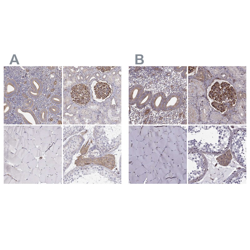 non-muscle Myosin IIA Antibody Immunohistochemistry-Paraffin: non-muscle Myosin IIA Antibody Antibody [NBP2-62644]