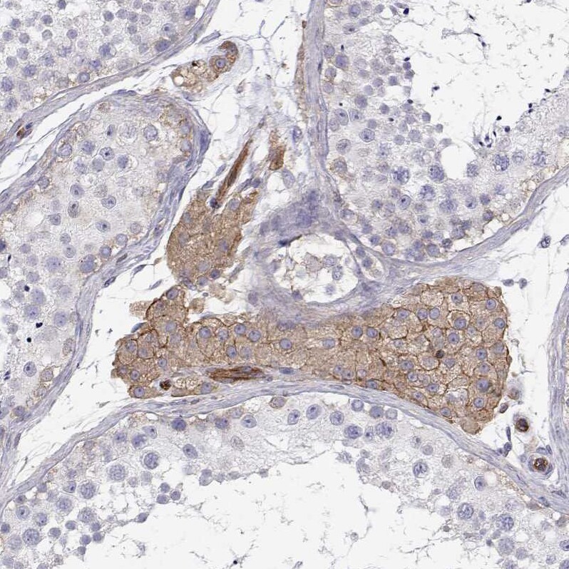 non-muscle Myosin IIA Antibody
