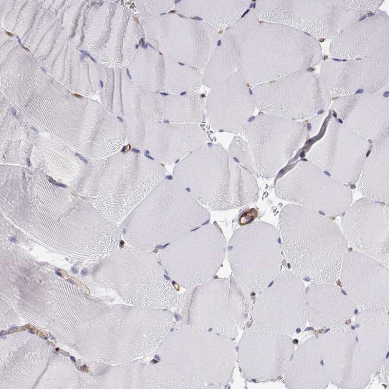 non-muscle Myosin IIA Antibody
