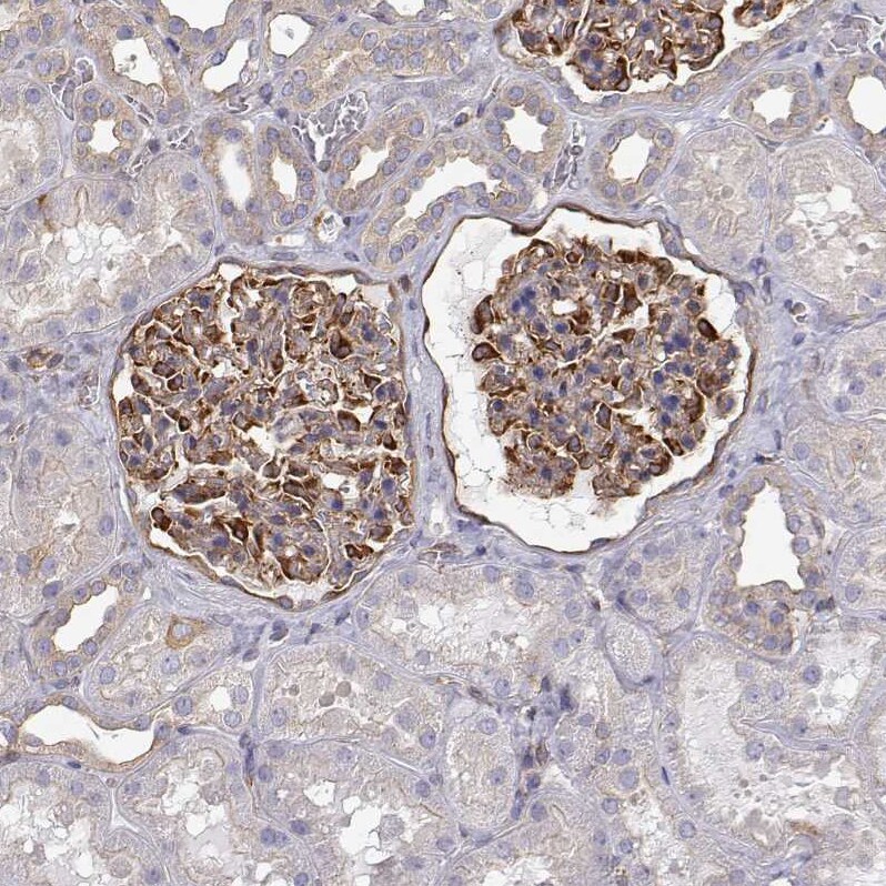 non-muscle Myosin IIA Antibody