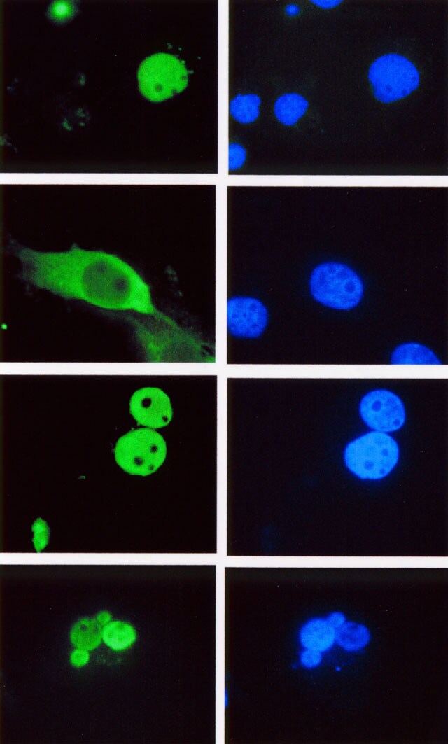LEF1 Antibody (REMB6)