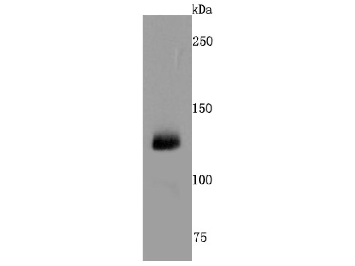 CD41/CD61 Antibody (JM11-19) Western Blot: CD41/CD61 Antibody (JM11-19) [NBP2-66757]