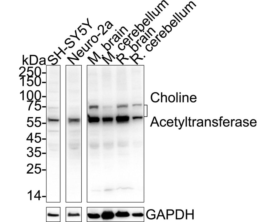 Choline Acetyltransferase/ChAT Antibody (JA67-11) Western Blot: Choline Acetyltransferase/ChAT Antibody (JA67-11) [NBP2-66779]