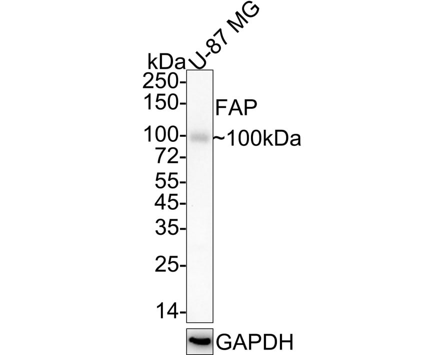 Fibroblast Activation Protein alpha/FAP Antibody (JA56-11) Western Blot: Fibroblast Activation Protein alpha/FAP Antibody (JA56-11) [NBP2-66844]