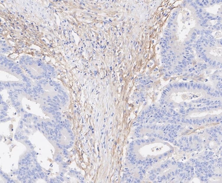 Fibroblast Activation Protein alpha/FAP Antibody (JA56-11)