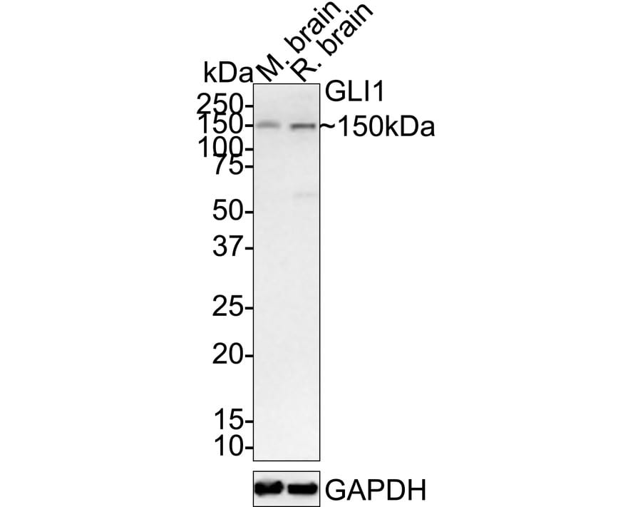 GLI-1 Antibody (JF09-08) Western Blot: GLI-1 Antibody (JF09-08) [NBP2-66867]