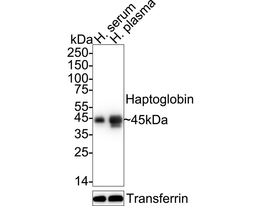 Haptoglobin Antibody (JM10-79) Western Blot: Haptoglobin Antibody (JM10-79) [NBP2-66881]