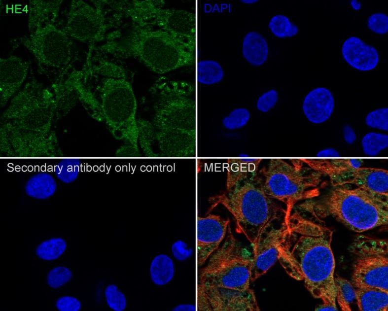 HE4/WFDC2 Antibody (JF62-09)