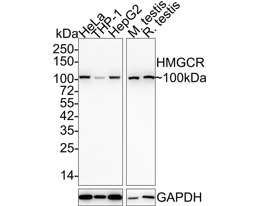 HMG-CoA Reductase/HMGCR Antibody (JF0981) Western Blot: HMG-CoA Reductase/HMGCR Antibody (JF0981) [NBP2-66888]