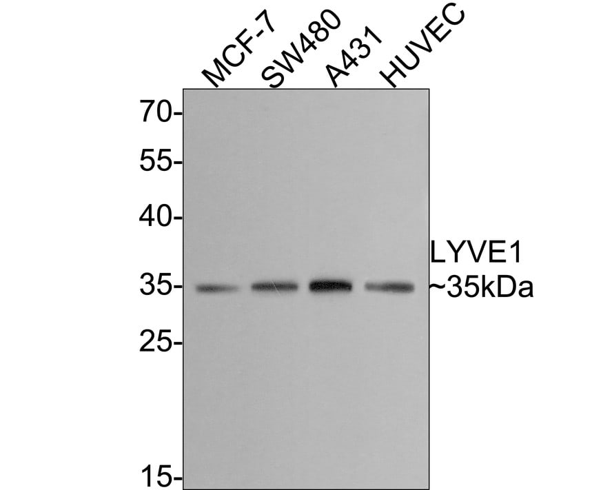 LYVE-1 Antibody (JF0979)