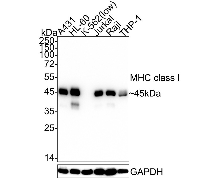 MHC Class I Antibody (JF10-38) Western Blot: MHC Class I Antibody (JF10-38) [NBP2-66946]