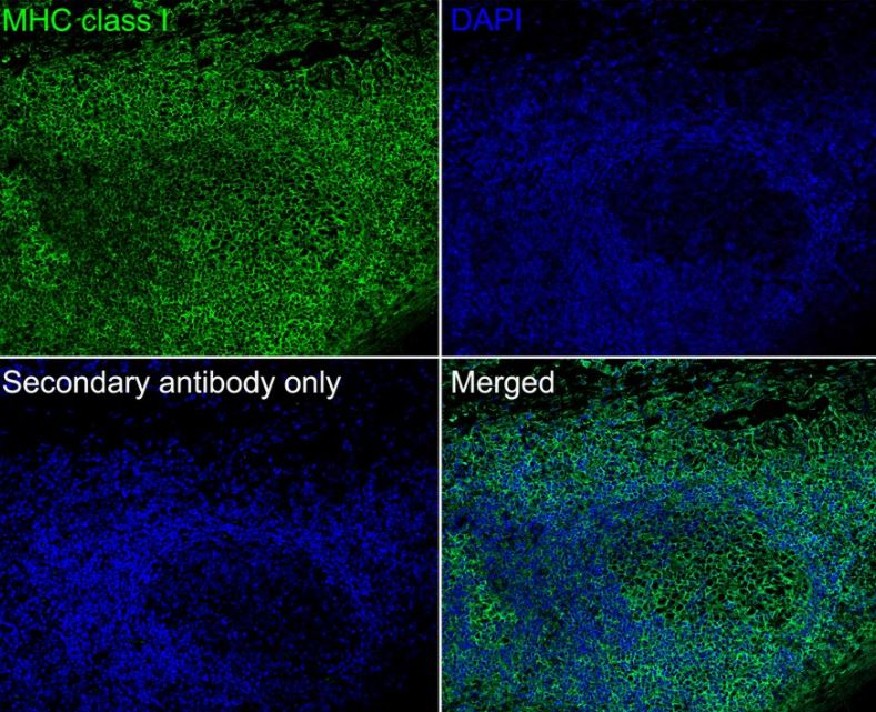 MHC Class I Antibody (JF10-38)