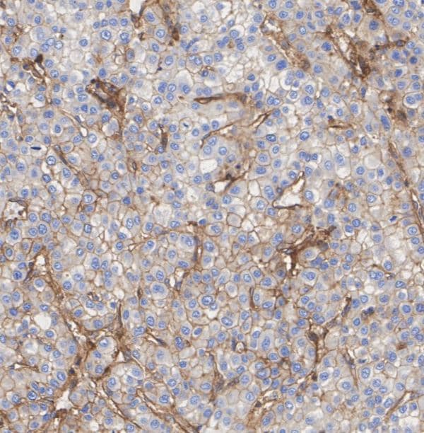 MHC Class I Antibody (JF10-38)