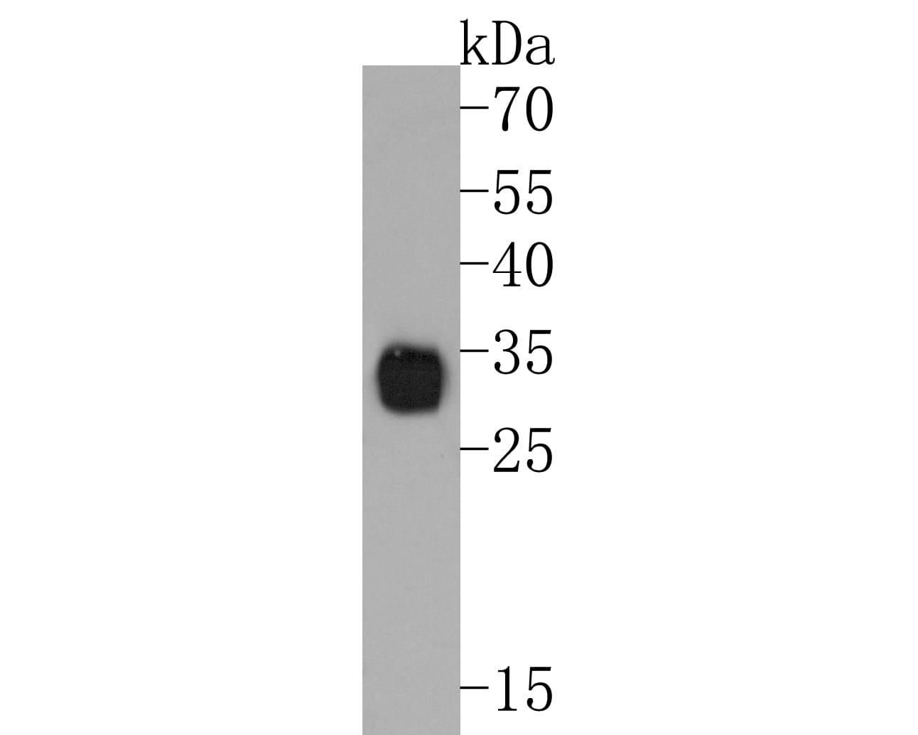Neutrophil Elastase/ELA2 Antibody (JF098-6) Western Blot: Neutrophil Elastase/ELA2 Antibody (JF098-6) [NBP2-66972]