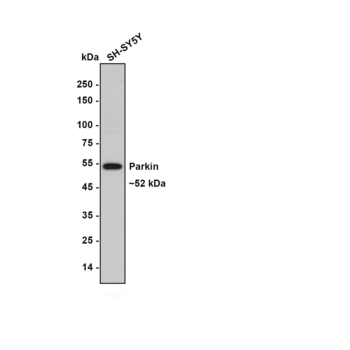 Parkin Antibody (JF82-09) Western Blot: Parkin Antibody (JF82-09) [NBP2-67017]
