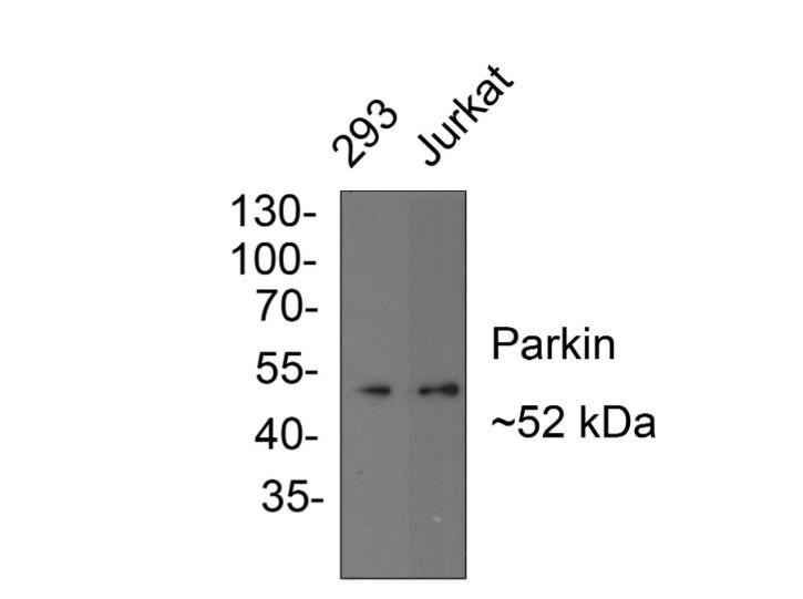 Parkin Antibody (JF82-09)