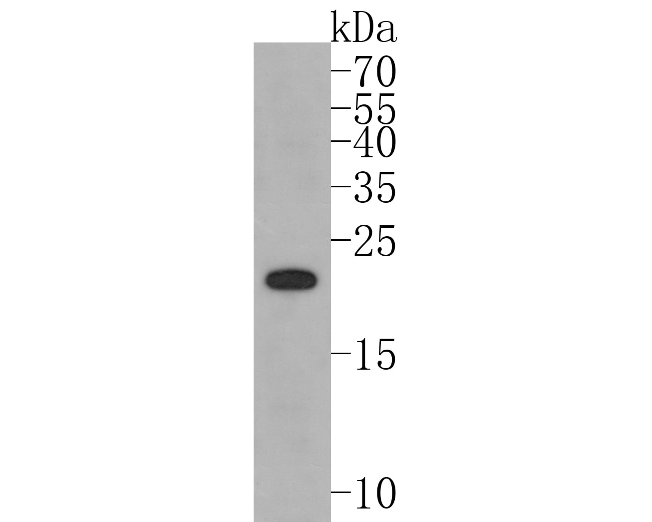 PMP22 Antibody (JM52-30) Western Blot: PMP22 Antibody (JM52-30) [NBP2-67068]
