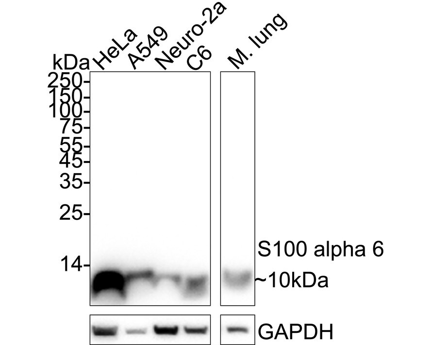 S100A6 Antibody (JF0976) Western Blot: S100A6 Antibody (JF0976) [NBP2-67123]