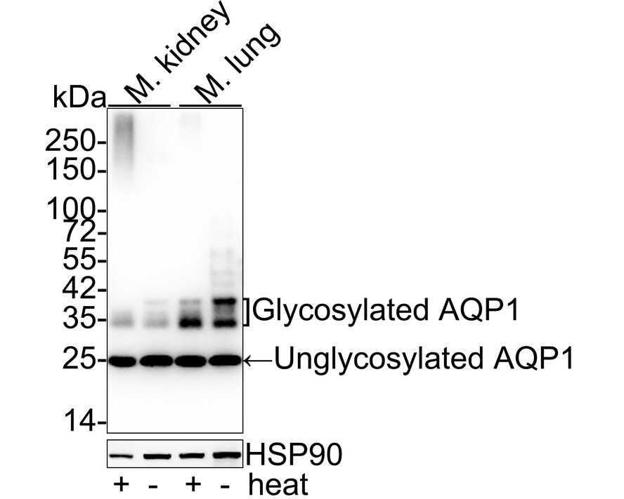 Aquaporin 1/AQP1 Antibody (JM10-98) Western Blot: Aquaporin 1/AQP1 Antibody (JM10-98) [NBP2-67162]