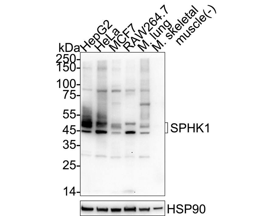 Sphingosine Kinase 1/SPHK1 Antibody (JA31-14) Western Blot: Sphingosine Kinase 1/SPHK1 Antibody (JA31-14) [NBP2-67164]