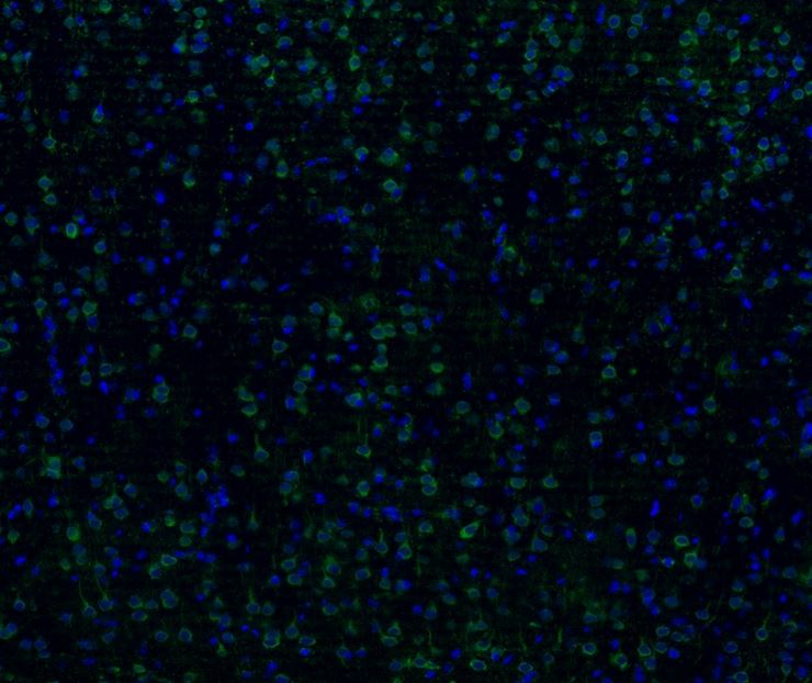 TACE/ADAM17 Antibody (JM10-35)