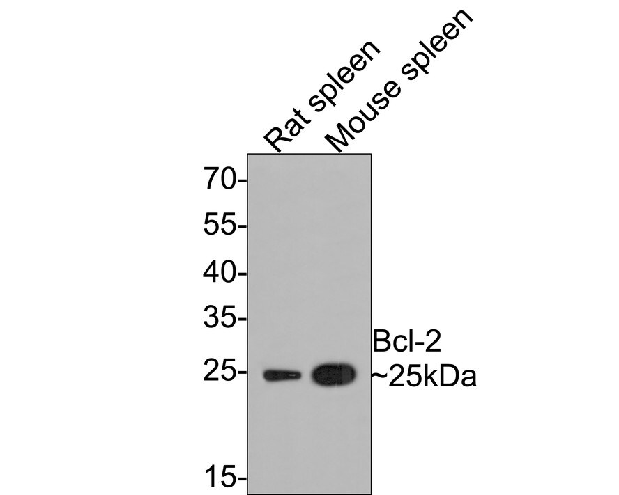 Bcl-2 Antibody (JF104-8) Western Blot: Bcl-2 Antibody (JF104-8) [NBP2-67182]