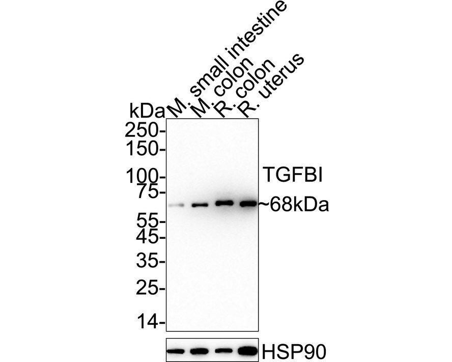 Beta Ig-h3/TGFBI Antibody (JM24-53) Western Blot: Beta Ig-h3/TGFBI Antibody (JM24-53) [NBP2-67186]