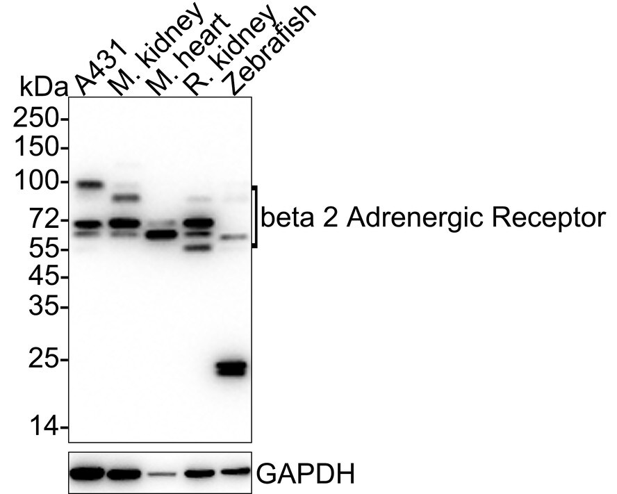 beta-2 Adrenergic R/ADRB2 Antibody (JM102-06) Western Blot: beta-2 Adrenergic R/ADRB2 Antibody (JM102-06) [NBP2-67187]