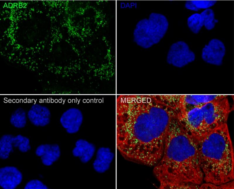 beta-2 Adrenergic R/ADRB2 Antibody (JM102-06)