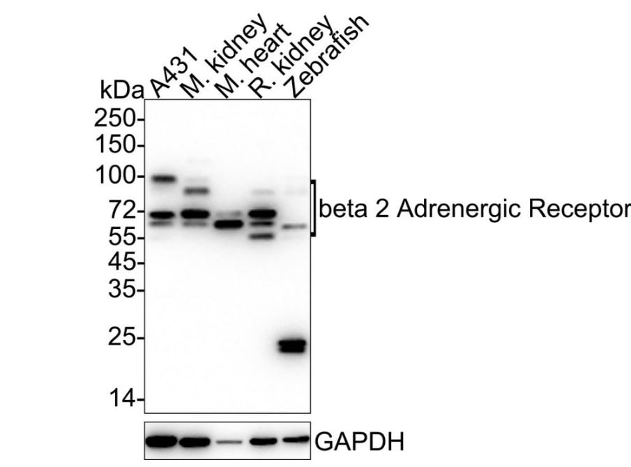 beta-2 Adrenergic R/ADRB2 Antibody (JM102-06)