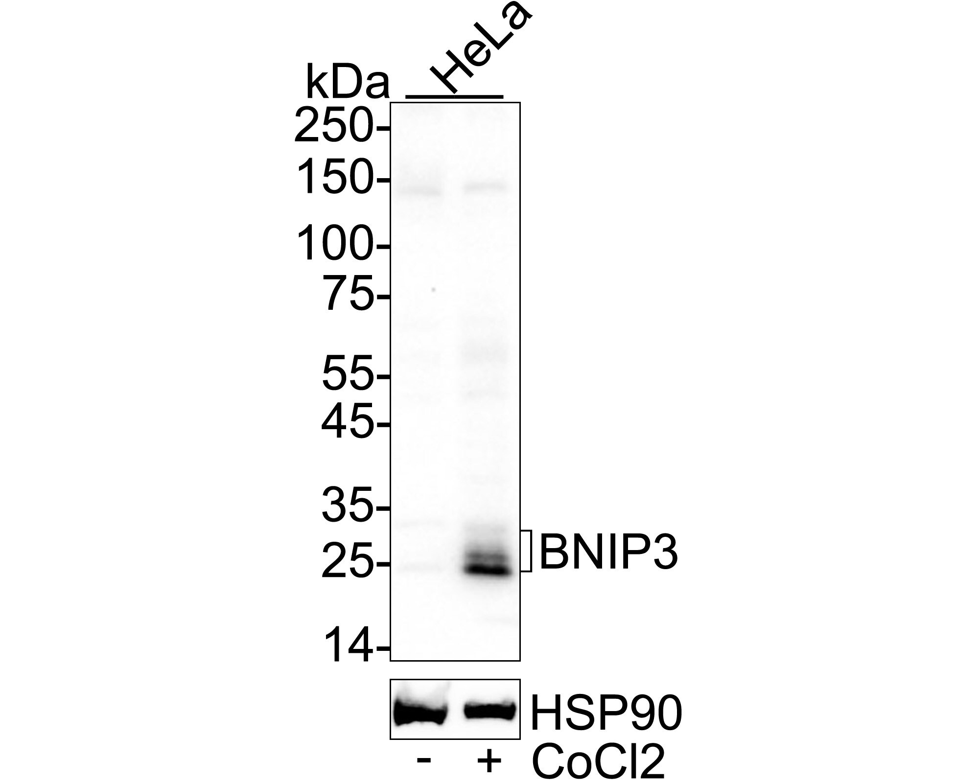 BNIP3 Antibody (JA71-10) Western Blot: BNIP3 Antibody (JA71-10) [NBP2-67192]