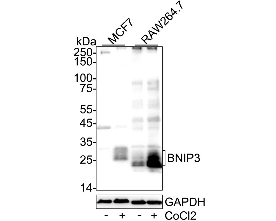 BNIP3 Antibody (JA71-10) Western Blot: BNIP3 Antibody (JA71-10) [NBP2-67192]