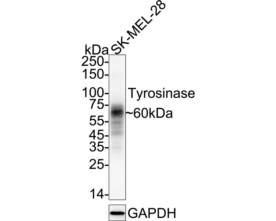 Tyrosinase Antibody (JA52-11) Western Blot: Tyrosinase Antibody (JA52-11) [NBP2-67232]
