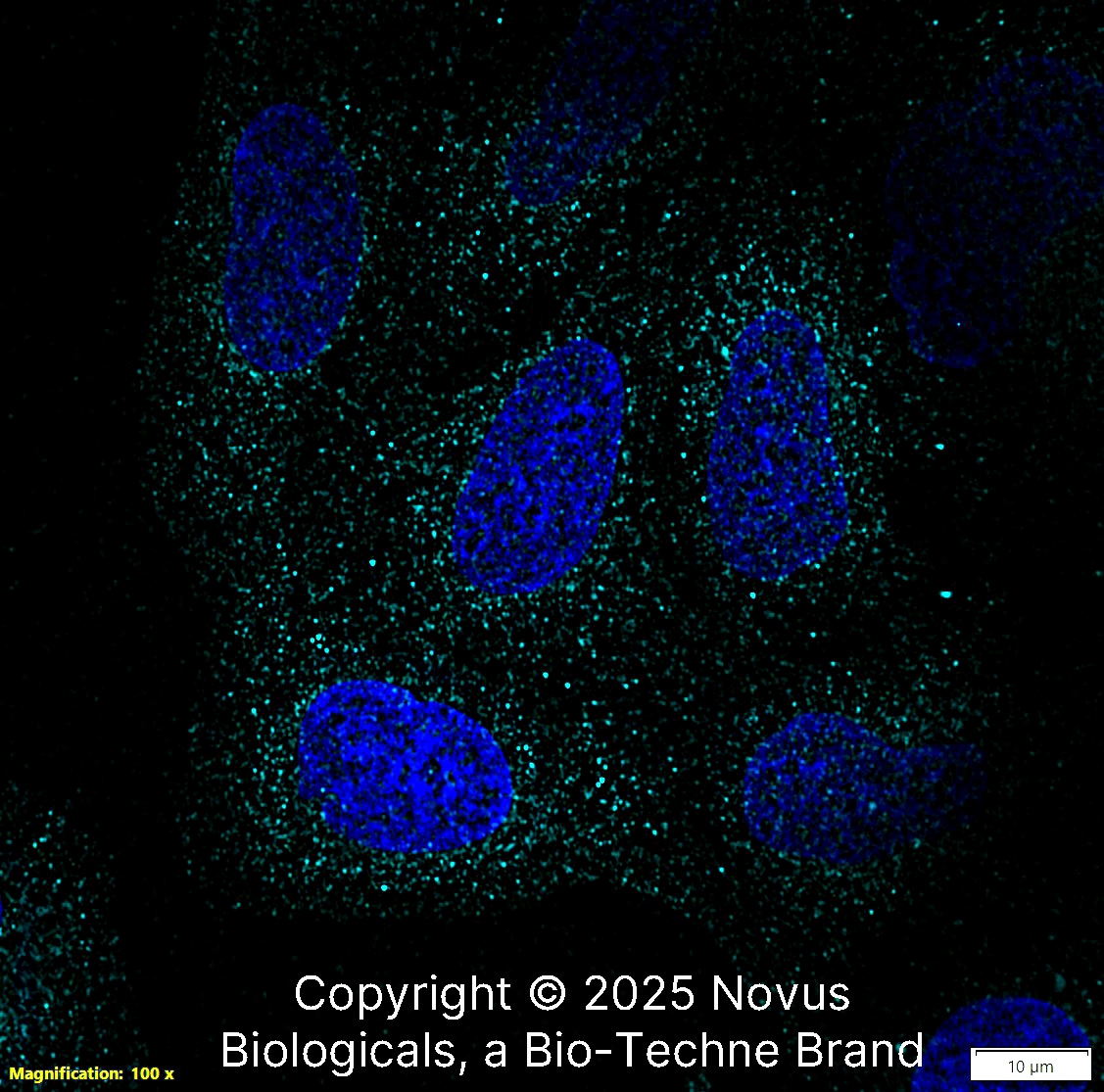 Aquaporin-5 Antibody [Alexa Fluor® 647]