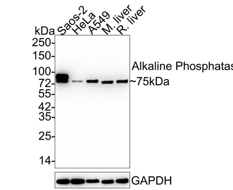 Alkaline Phosphatase, Tissue Non-Specific Antibody (SA40-00)