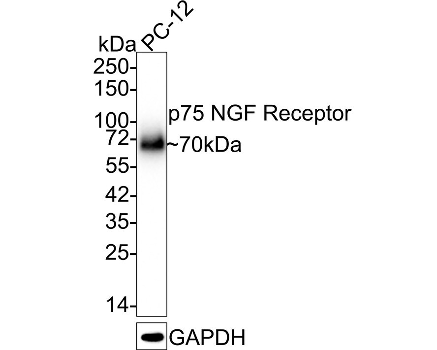 NGFR/TNFRSF16/p75NTR Antibody (SA39-02) Western Blot: NGFR/TNFRSF16/p75NTR Antibody (SA39-02) [NBP2-67296]